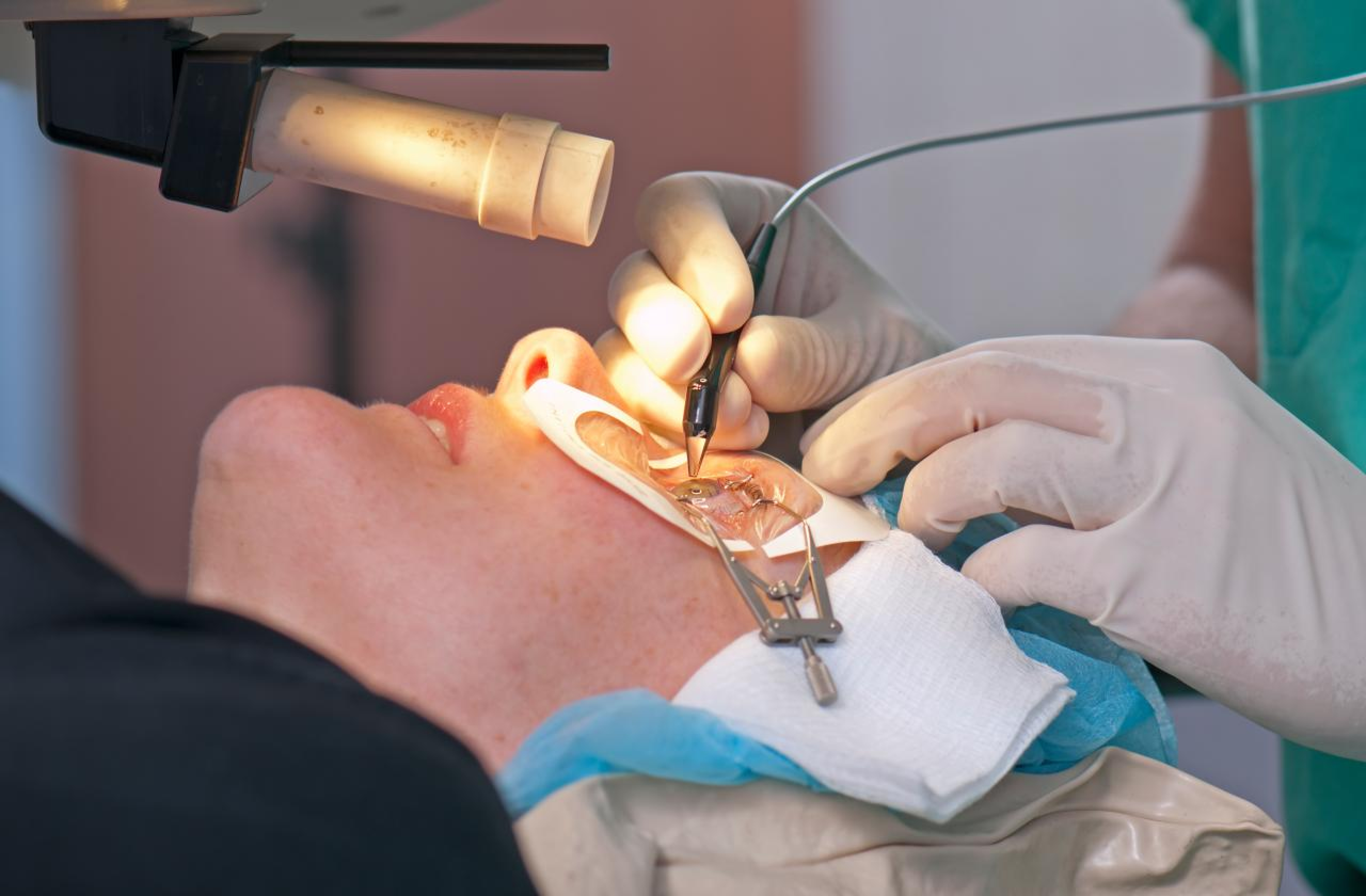 LASIK Eye Surgery